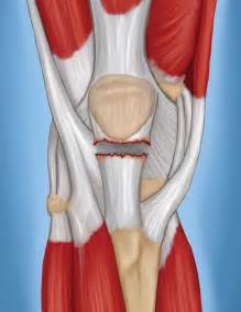 test for patellar tendon tear|torn patellar tendon symptoms.